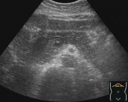c-pancreatitis1c.jpg c-pancreatitis1c.jpg