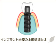 �C���v�����g���Â̏㕔�\���Ƃ�