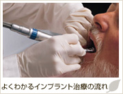 �悭�킩��C���v�����g���Â̗���