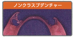 バルプラスト