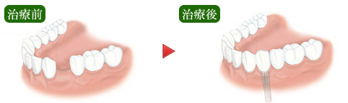 ����1�{�������ꍇ�̗�