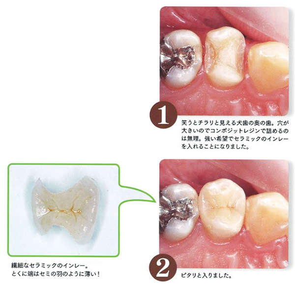 自費治療