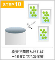 抜歯から保管完了通知まで