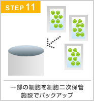 抜歯から保管完了通知まで
