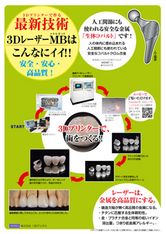3Dレーザーメタルボンド